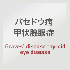 バセドウ病甲状腺眼症：Graves' disease thyroid eye disease