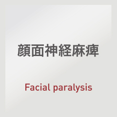 顔面神経麻痺：Facial paralysis