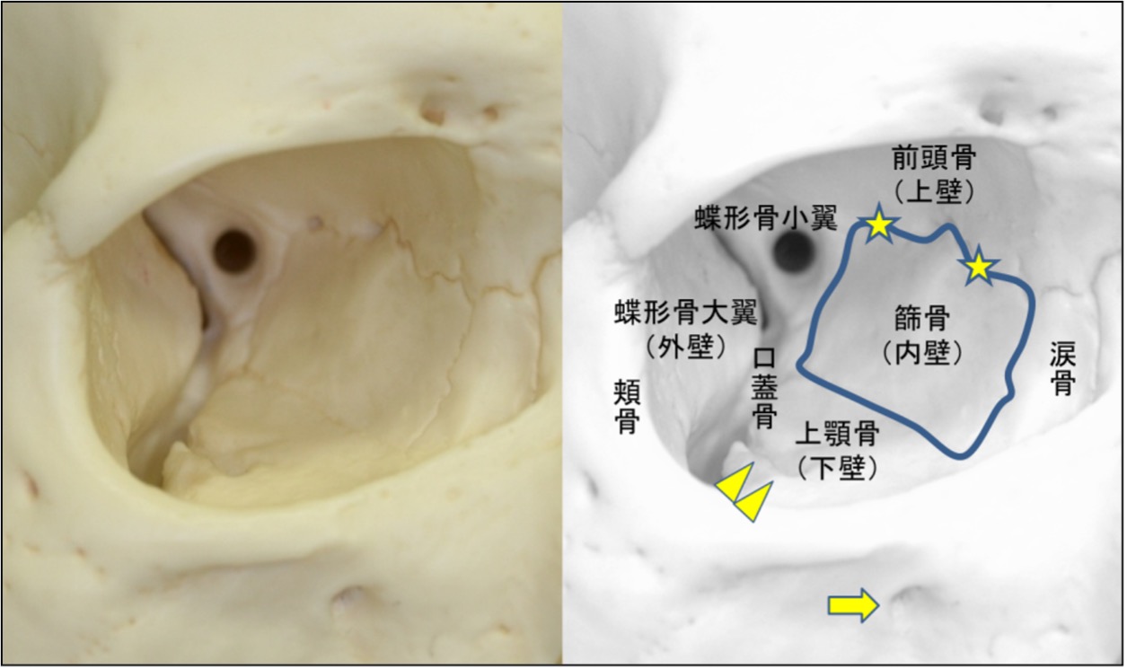 眼窩内壁のスケールモデル